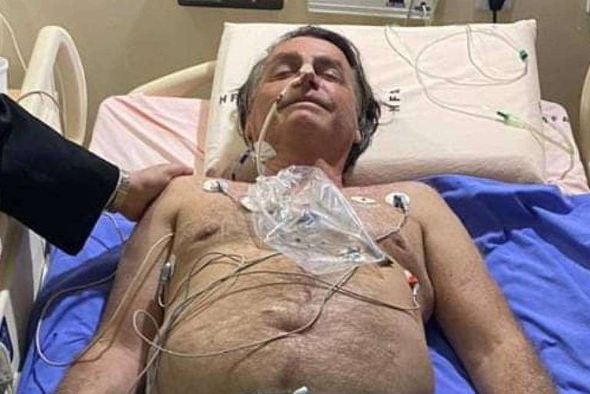 Bolsonaro tem sonda retirada, iniciará alimentação e apresenta melhora, diz novo boletim - Vimarsana News