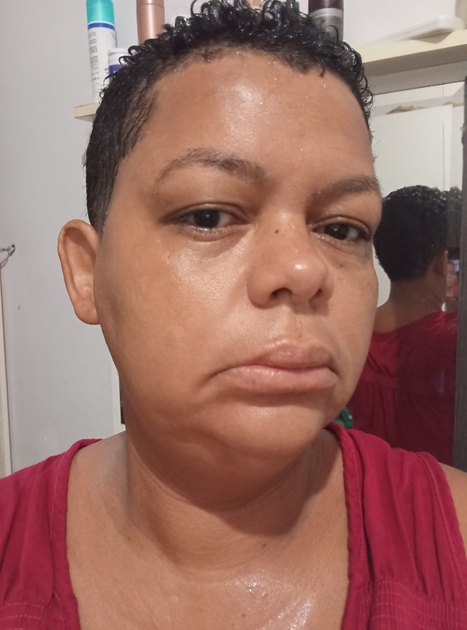 Mãe líder comunitária fez cinco cirurgias por causa de agulha cravada na boca | Diario de Cuiabá
